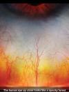 The human eye (sclera) close looks like a spooky forest 